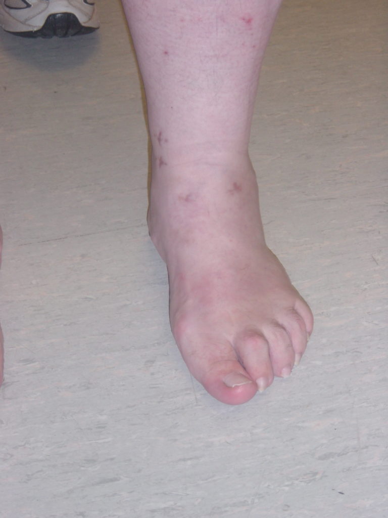 DSC00113_2 The Foot and Ankle Clinic