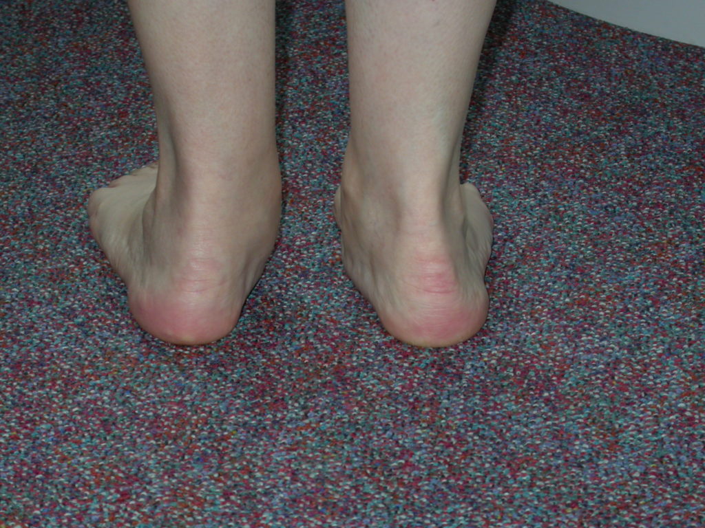 DSCN2627 The Foot and Ankle Clinic DSCN2627 The Foot and Ankle Clinic