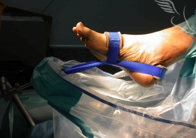 Ankle Arthroscopy